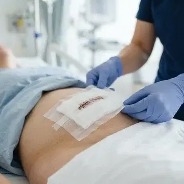 Surgical Wound Dressing